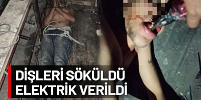 Maaşını isteyen 22 yaşındaki genç, patronlarından elektrikle işkence gördü: Adalete nasıl güveneceğim?