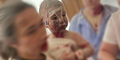 Ölü ve yaralılar var: Rusya, ülkenin en büyük çocuk hastanesini vurdu